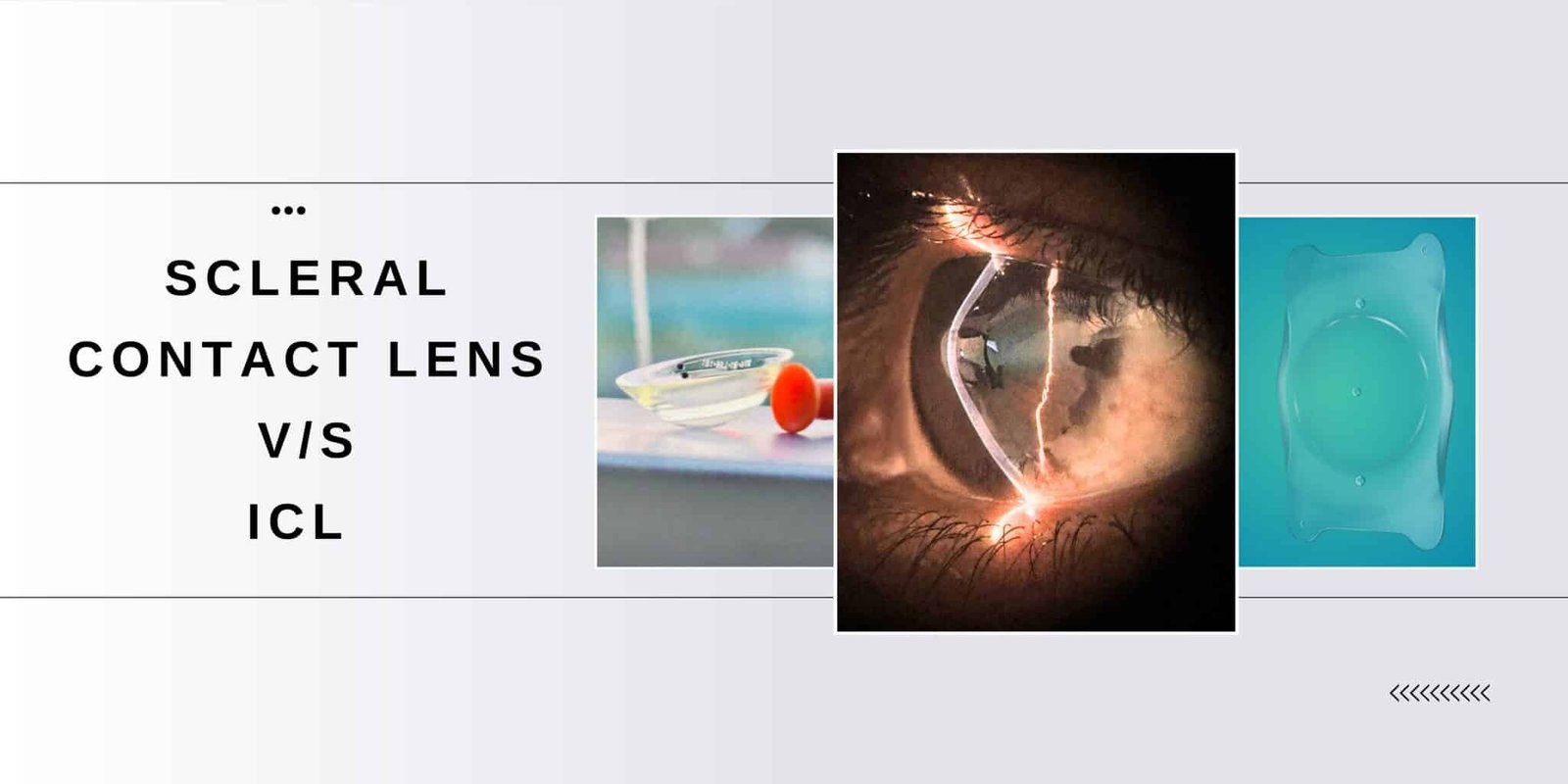 Scleral Lens Vs ICL correction in keratoconus - Reform Vision