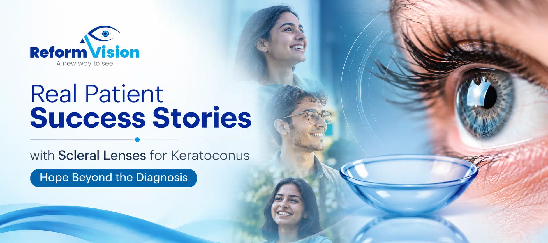 Real Patient Success Stories with Scleral Lenses for Keratoconus Hope Beyond the Diagnosis