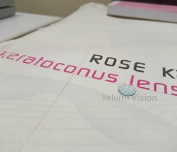 ROSE K2/RIGID GAS PERMIABLE CONTACT LENS INSERTION AND REMOVAL