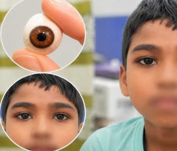 pediatricartificialey